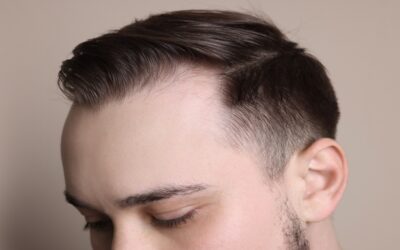 Haircuts for Guys with Receding Hairlines