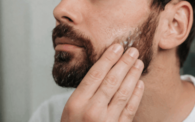 How to Treat Dry Skin Under a Beard
